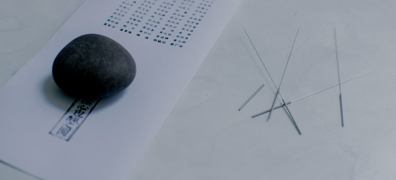 acupuncture-89.webp
